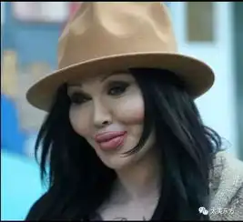 整容发达的不只一个国家,哪些欧美女星也动了