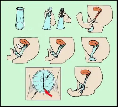 女生戴的套套,到底长啥样