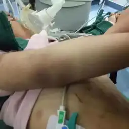 3岁女童遭后妈虐待致死手段残忍令人发指网友们都怒了