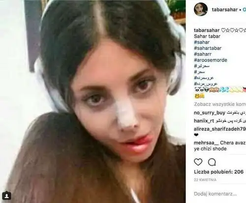 伊朗女孩整成了僵尸朱莉被判刑,如今终于露出真实面容