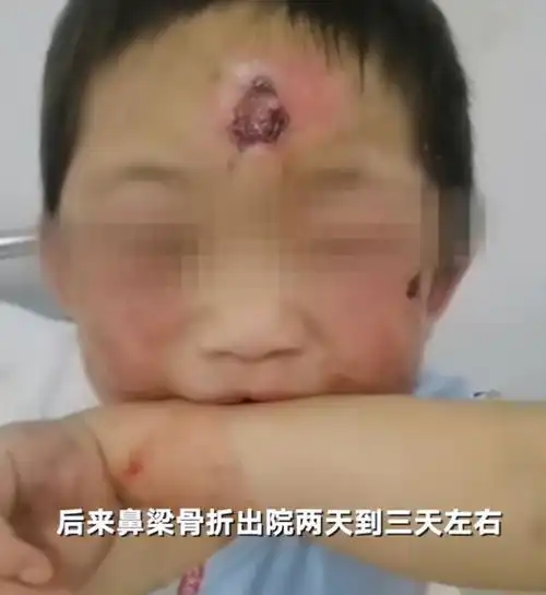 六岁女童遭生母虐待事件证明,不负责任的婚姻就是一种犯罪