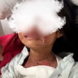 韶关六岁女童被六年级男生泼开水,教育局回应系恶作剧,女童家属怒斥不实是校园霸凌