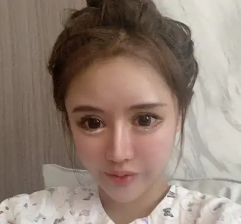 三年前,耗费上百万,整容六十余次的网红,如今能靠脸吃饭了吗