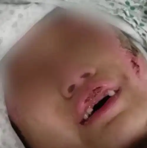 6岁女童遭亲妈及姘头狂虐3月,手段残忍,姥姥判死刑都不为过
