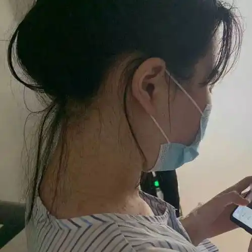 24岁女子患东方美女病,血管像70岁老人诱因竟是相思病