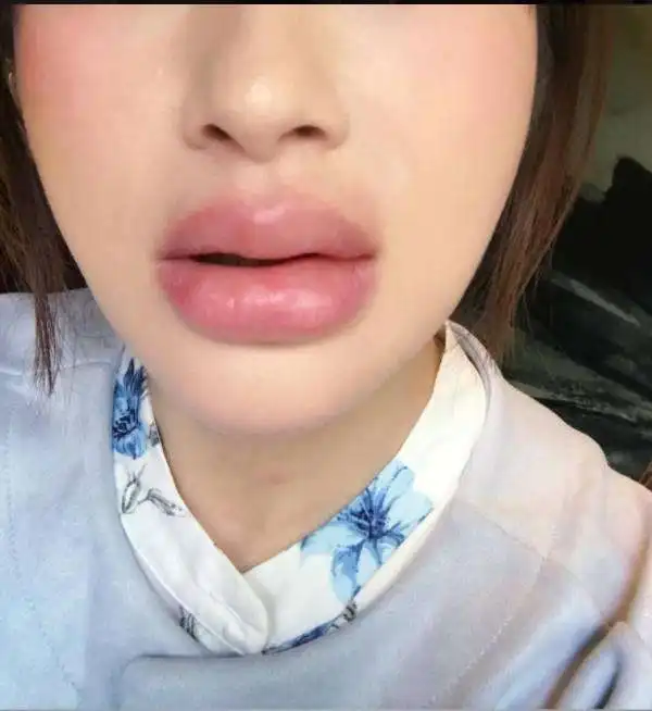 美女主播晒完香肠嘴再战素颜照网友看傻眼