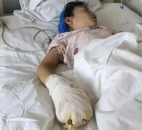 小女童遭继母虐待致残后续亲生父亲发声,自己绝对不会跟她和解