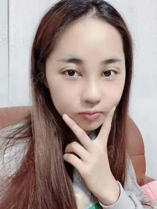 现在这个社会,对女孩子的要求总是那么的高,不仅要有...鼻部多项悦美整形