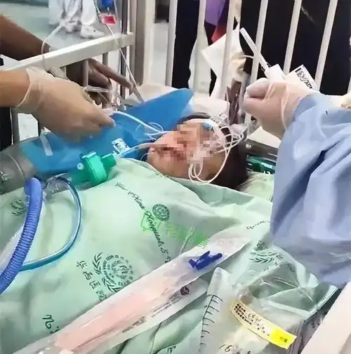 恶犬咬伤女孩腿骨,狗主人宁愿下跪求救,也不对自家狗下狠手爱犬遛狗大型犬网易订阅