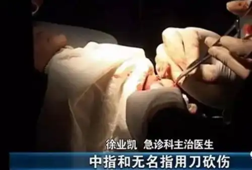 女童撑小花伞坠楼,疑为模仿动画片
