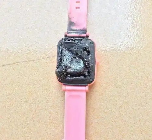 触目惊心4岁女童被严重烧伤,竟因电话手表突发自燃,紧急提醒很多小朋友天天佩戴