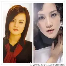 饼脸变锥子脸的30整容女星