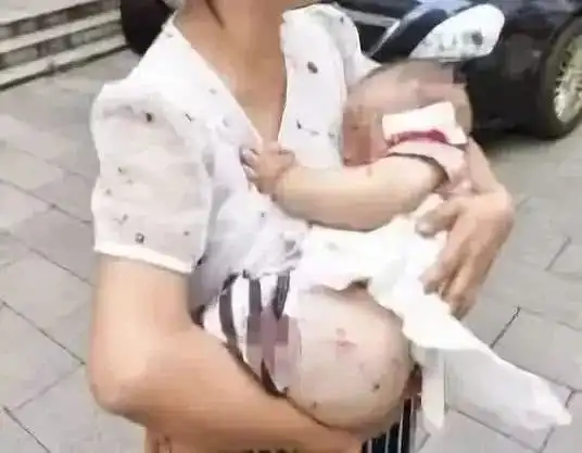 惨女童小区内被狗撕咬1分钟