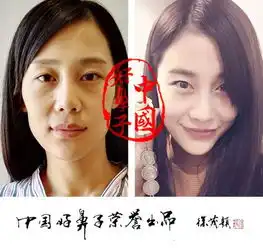 美词2016中国整形界年度新词榜