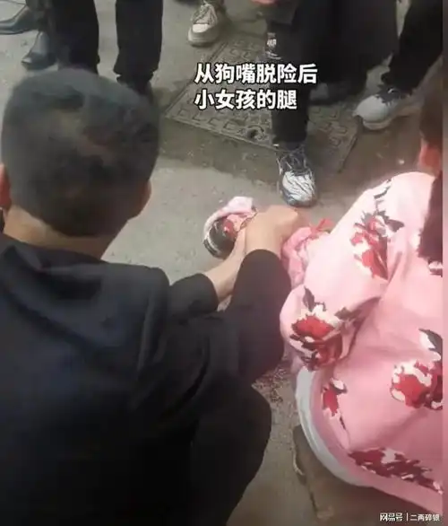 湖南常宁,黑犬当街撕咬小女孩,狗主人下跪道歉,打狗小哥发声