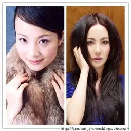 饼脸变锥子脸的30整容女星