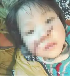 模仿动画片5岁孩子坠楼10岁女孩锯掉妹妹鼻子