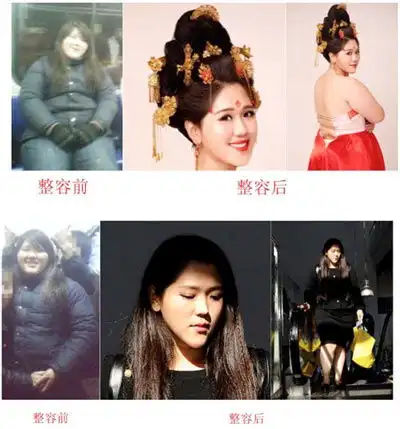 减出我人生200斤女胖子整容真人现身