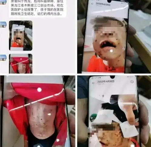 黑龙江受虐4岁女童抚养权由生父变更为生母